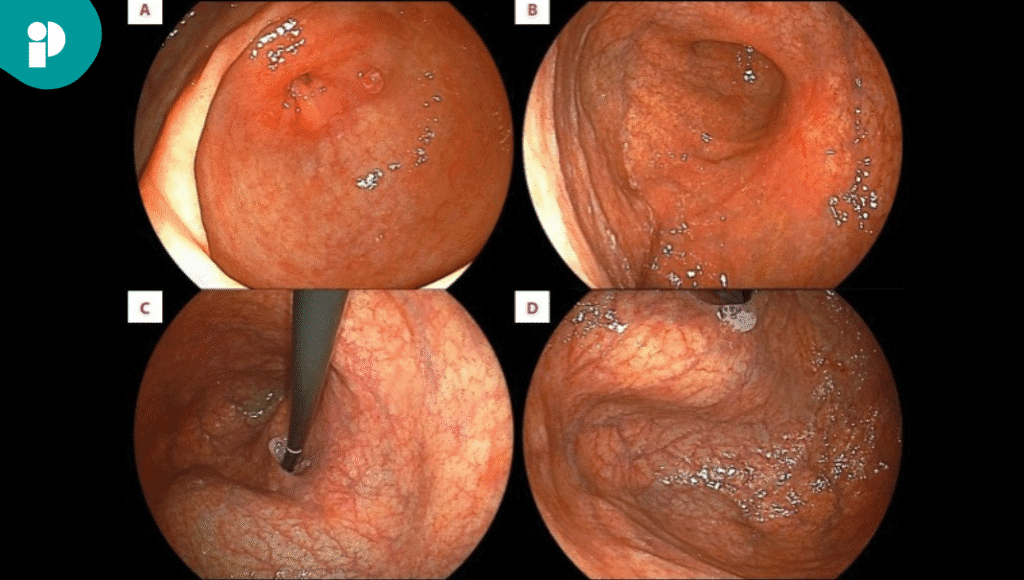 frame fotos notas ph latam 2025 07 10t170709.420