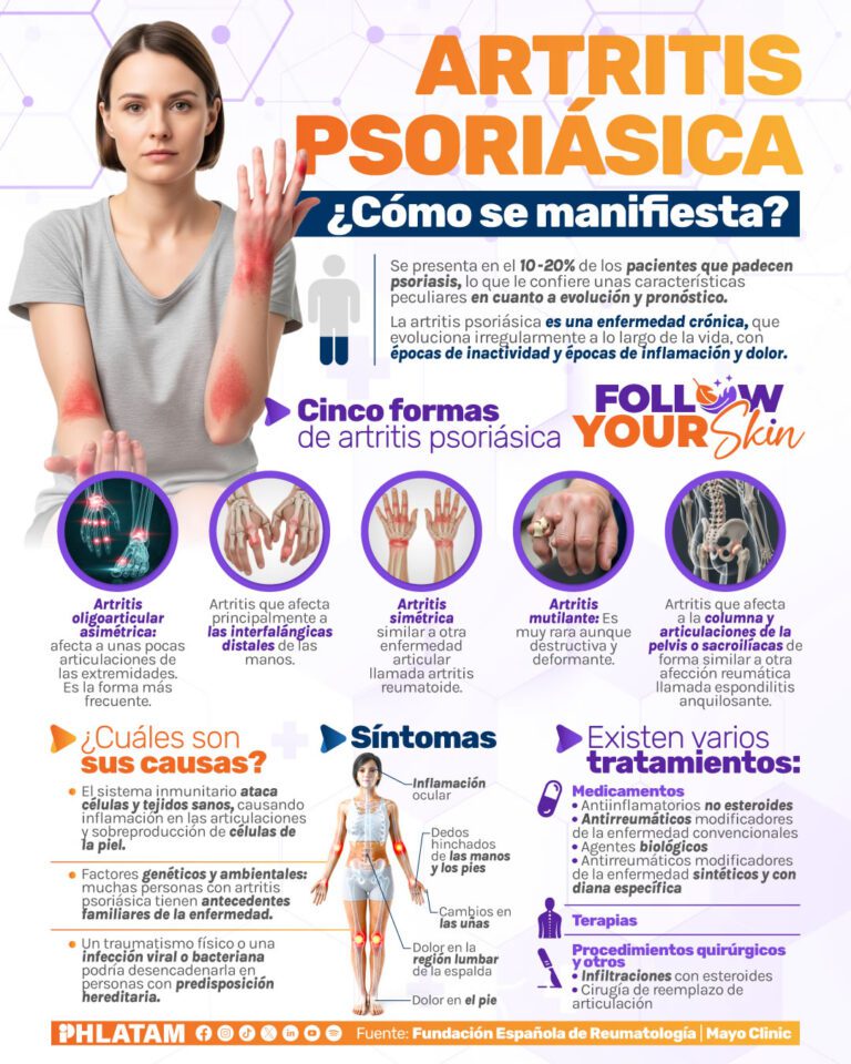 info artritis psoriásica