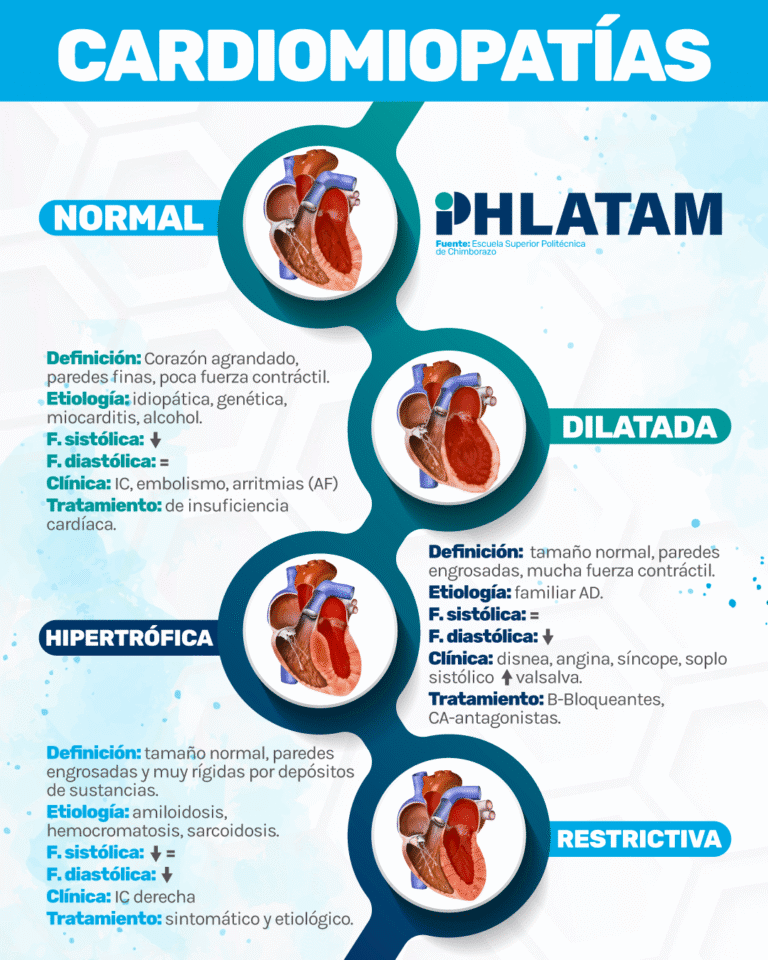 meme ig cardiomiopatias 02