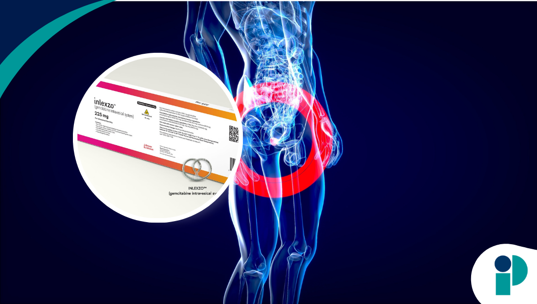 Inlexo Injection FDA aprueba INLEXZO, una innovadora terapia que transforma el ...