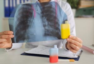 a,doctor,holds,a,vape,and,an,x ray,of,the