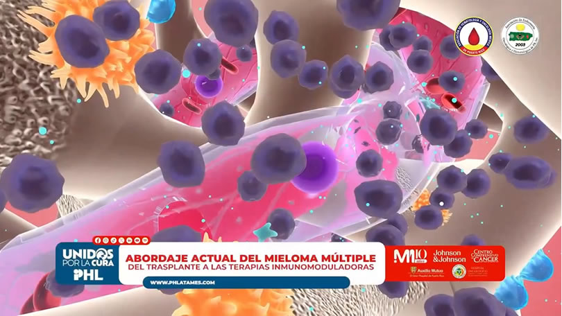 Abordaje actual del mieloma múltiple: del trasplante a las terapias inmunomoduladoras