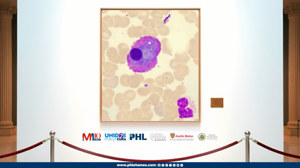 mieloma multiple nota no jj
