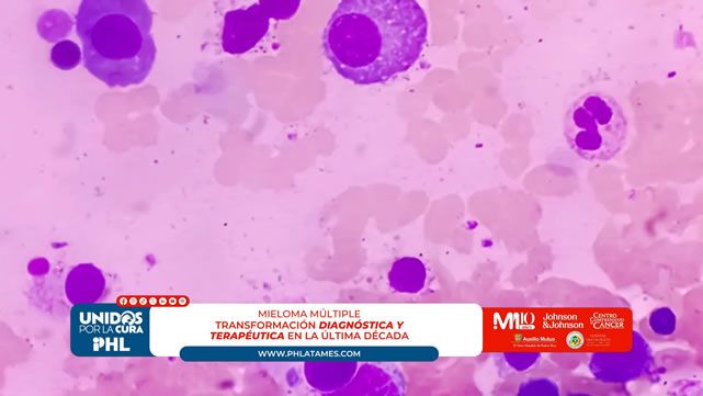 Mieloma múltiple: transformación diagnóstica y terapéutica en la última década