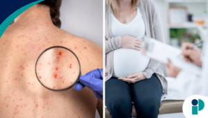 comunicado sÍfilis web