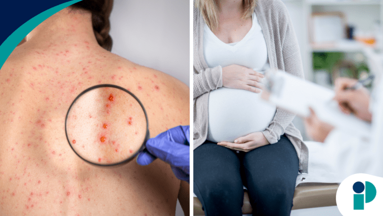 comunicado sÍfilis web