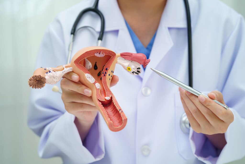 uterus,,doctor,holding,human,anatomy,model,for,study,diagnosis,and