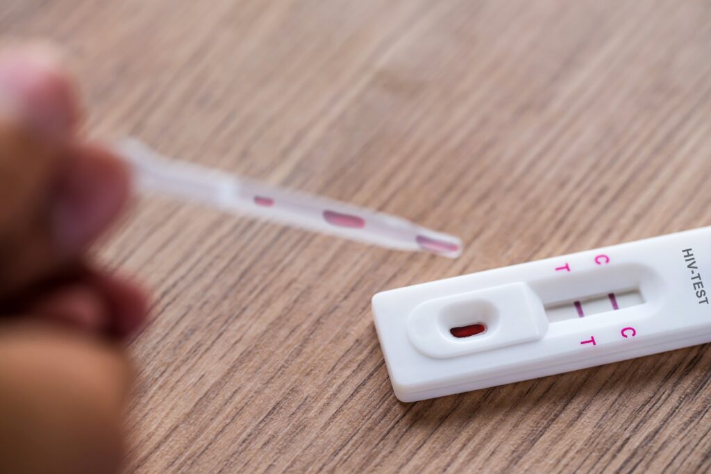 close,up,of,hiv,self testing,kit,with,positive,test,on