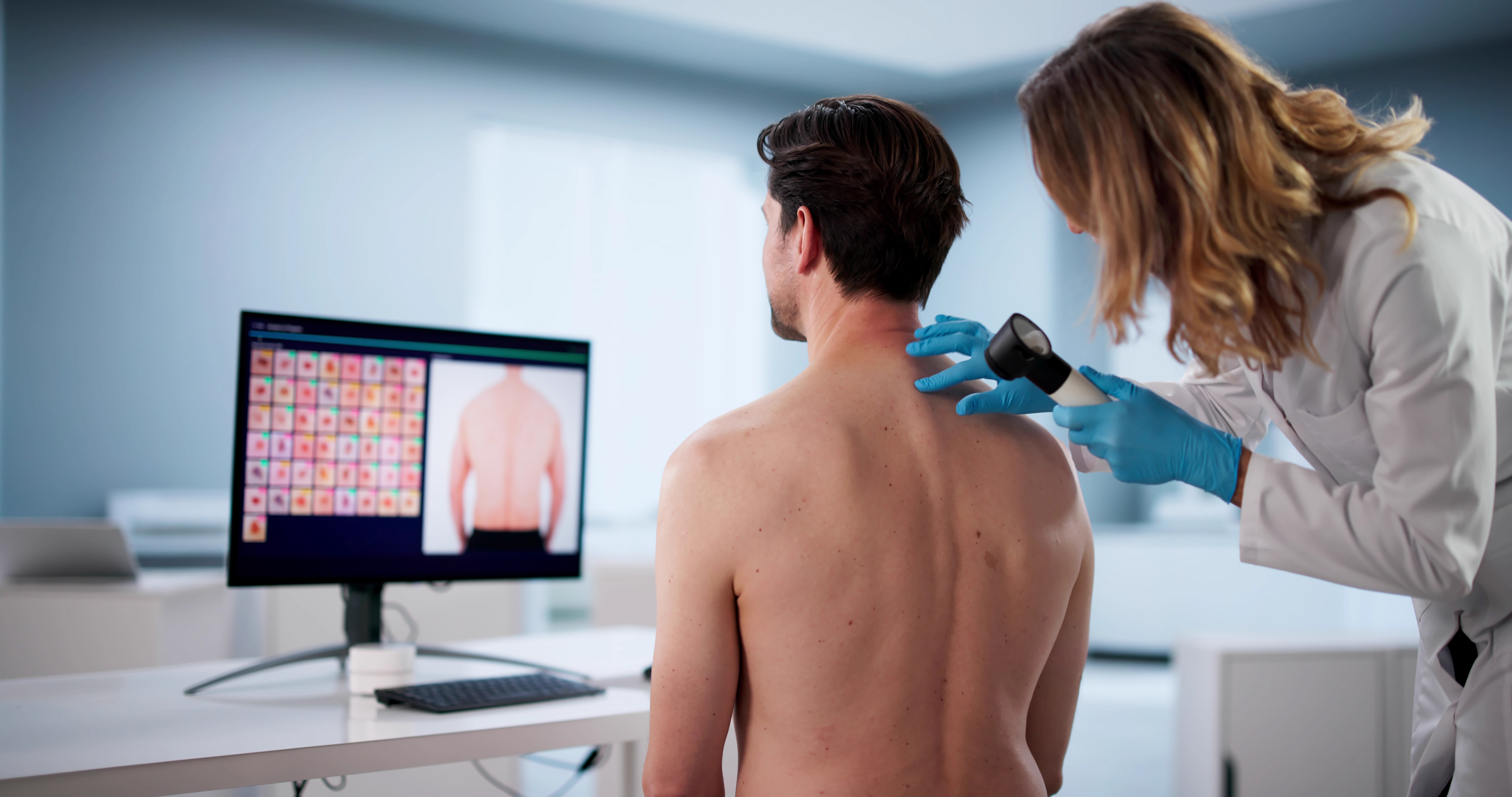 virtual,skin,examination,for,mole,,acne,,and,melanoma,cancer,diagnosis.