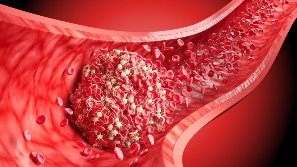 3d,illustration,of,a,blood,clot,formation,with,red,blood