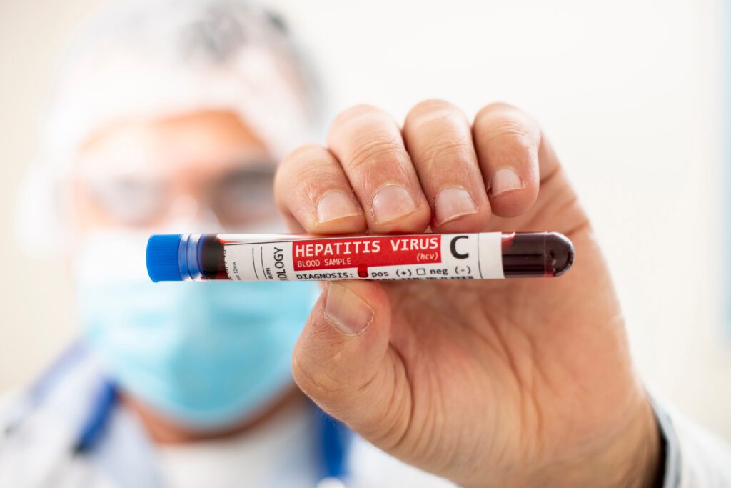 view,of,a,doctor,holding,a,fictional,test,tube,blood