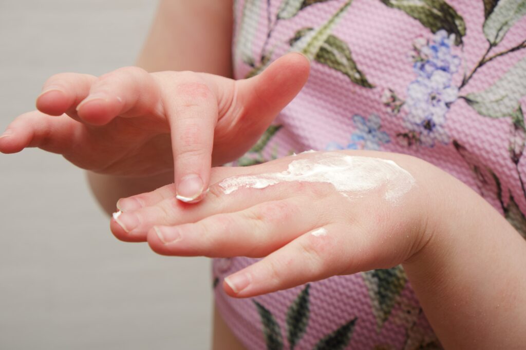 a,child,smears,his,hands,with,ointment,for,allergies,to