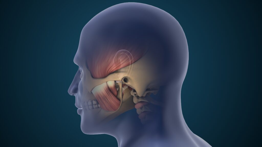 tmj,disorder,causing,jaw,pain,and,inflammation,3d,illustration