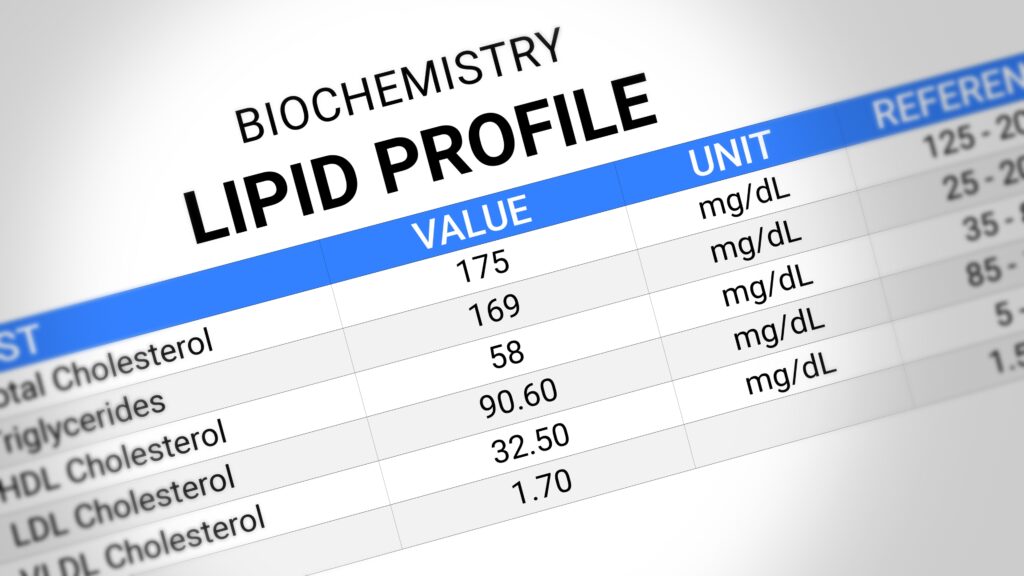 lipid,profile,test,report.,cholesterol,analysis,,heart,health,screening,,ldl,