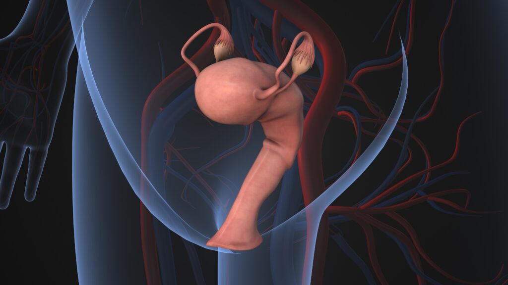 medical,animation,of,polycystic,ovary,syndrome,symptoms,3d,illustration