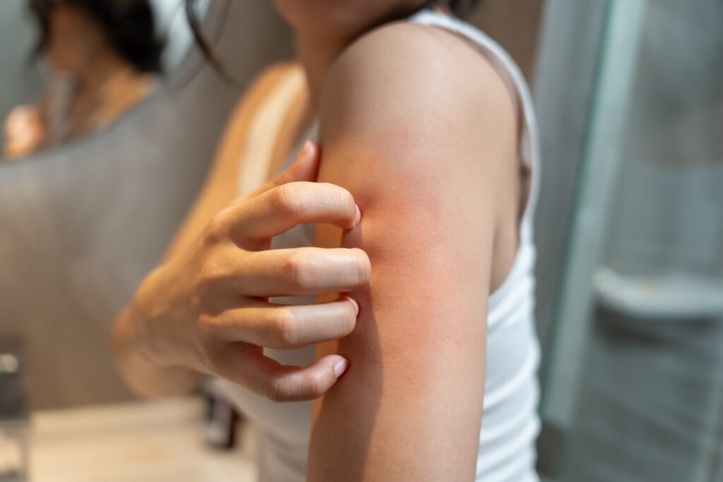 skin,problem,and,beauty.,woman,scratch,body,has,itchy,skin