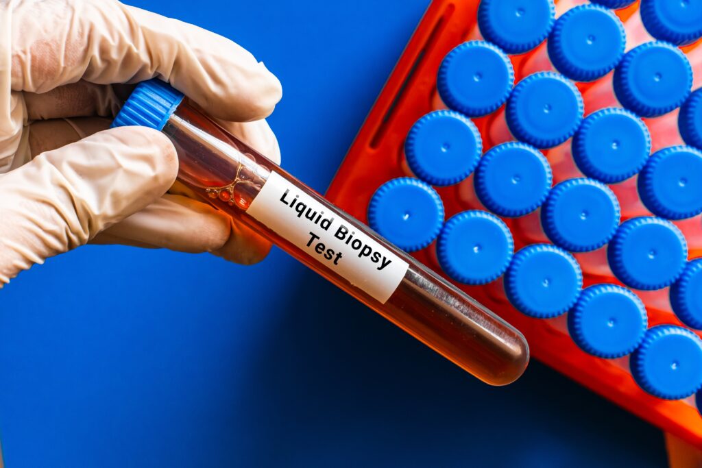 blood,sample,in,lab,tube,for,liquid,biopsy,test